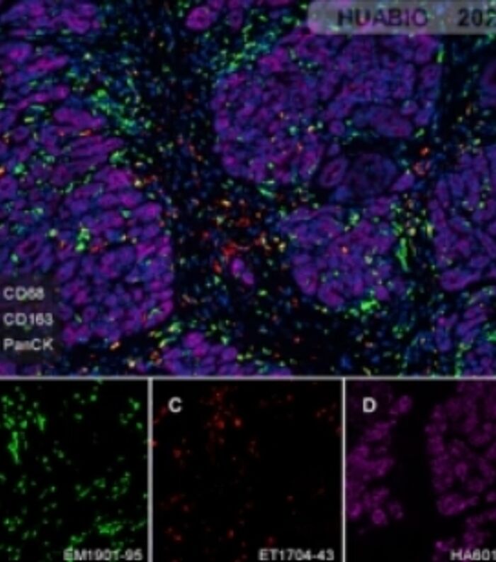 Intricacies of the Tumor Microenvironment