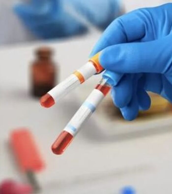 Types of Healthy Blood Biospecimens for Research