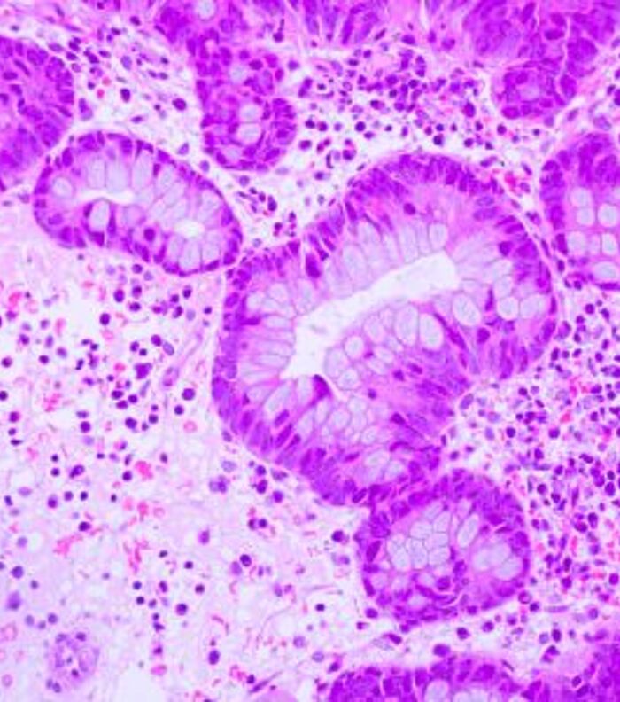 Modeling Tissue-Resident Lymphocyte-Stem Cell Interaction