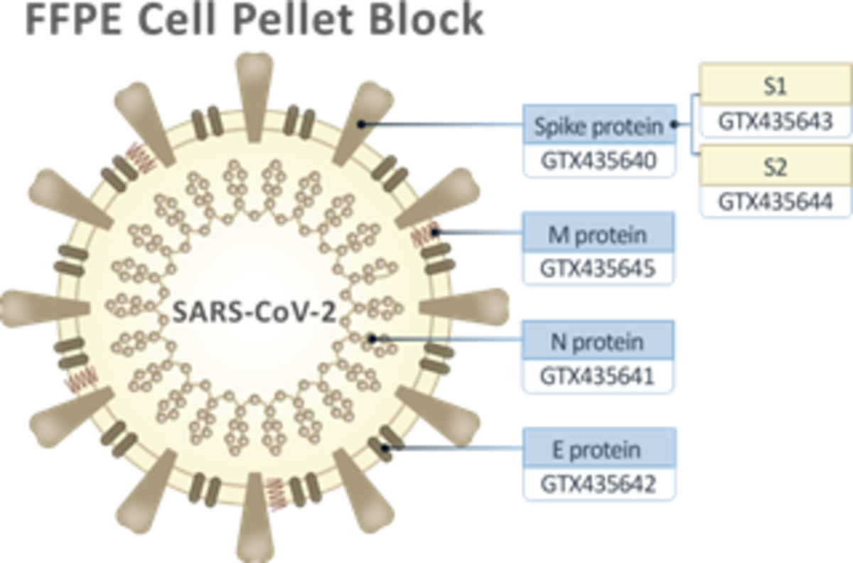 Positive controls for COVID-19: FFPE cell blocks, donor b