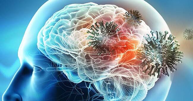 COVID-19 can invade the brain