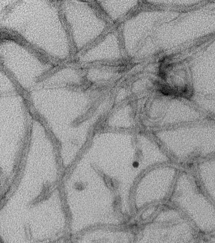 Novel Chemiluminescence Assay for NDD