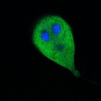 halloween contest entry gardia microscopy looking like ghost