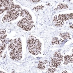 Anti GATA3 antibody for IHC