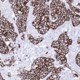 Anti Her2 antibody for IHC