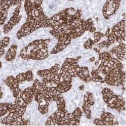 Anti e-cadherin antibody for IHC